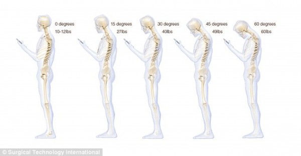 smartphone-texting-effects-human-body_02