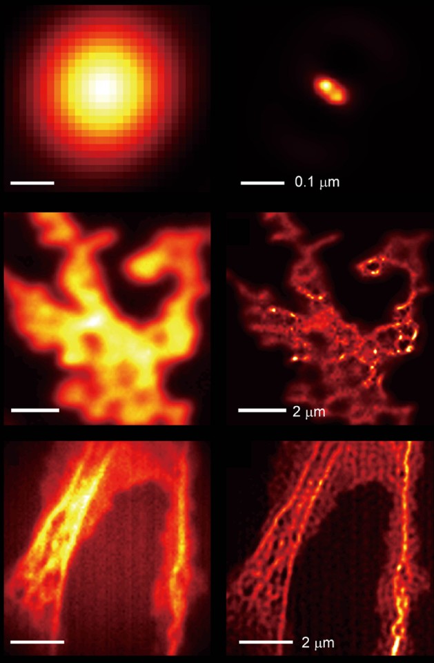 comparação de amostras de microscópio