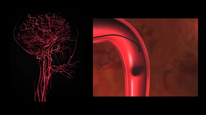 telerobotic system