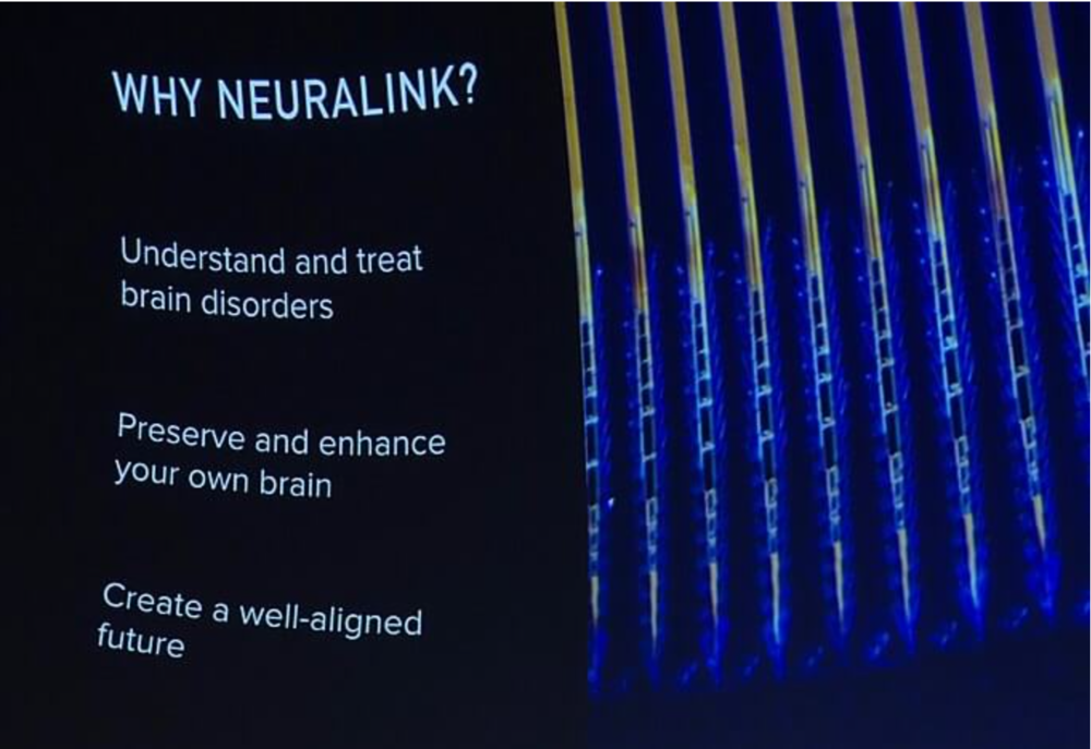 Neuralink