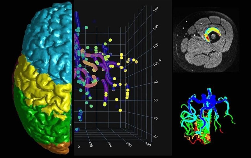 Human Brain Project 