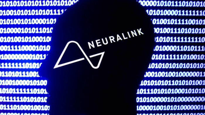 Neuralink