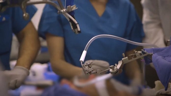 Robotic double lung transplant