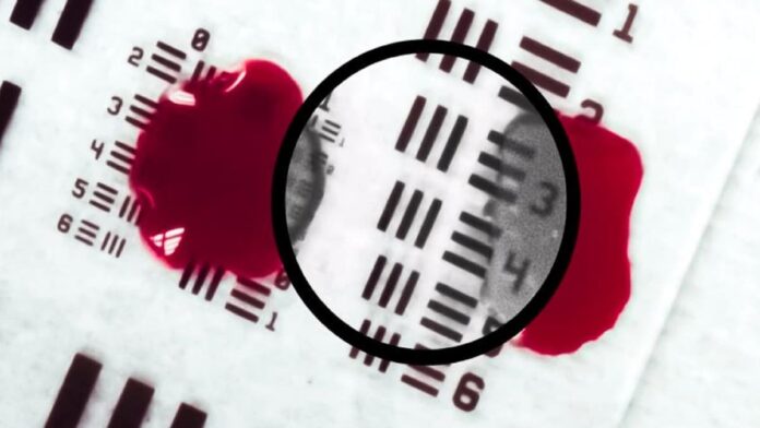 HemoLucence translucent blood