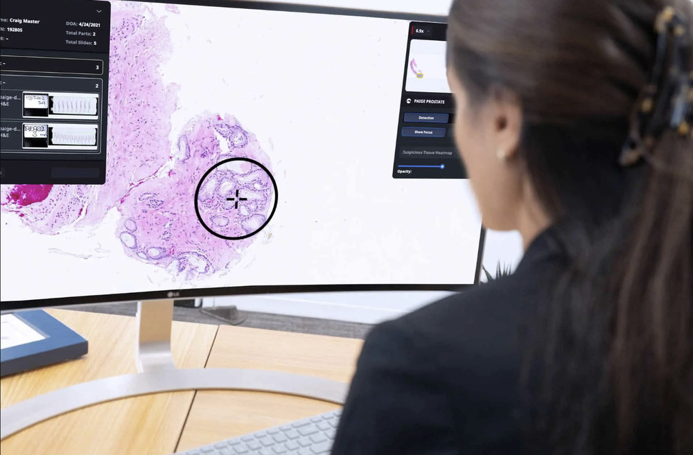 AI Medicine