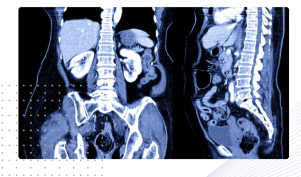 AI Medicine