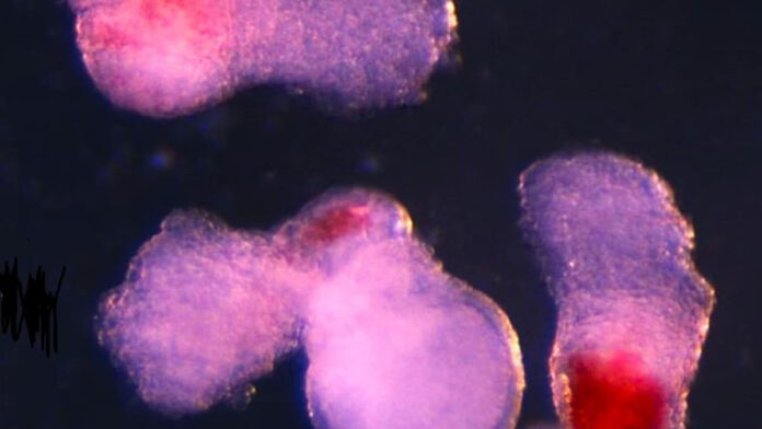 hematoids hematoids