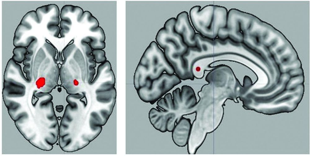 brain