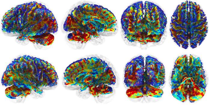 DOT (Digitally programmable Over-brain Therapeutic)