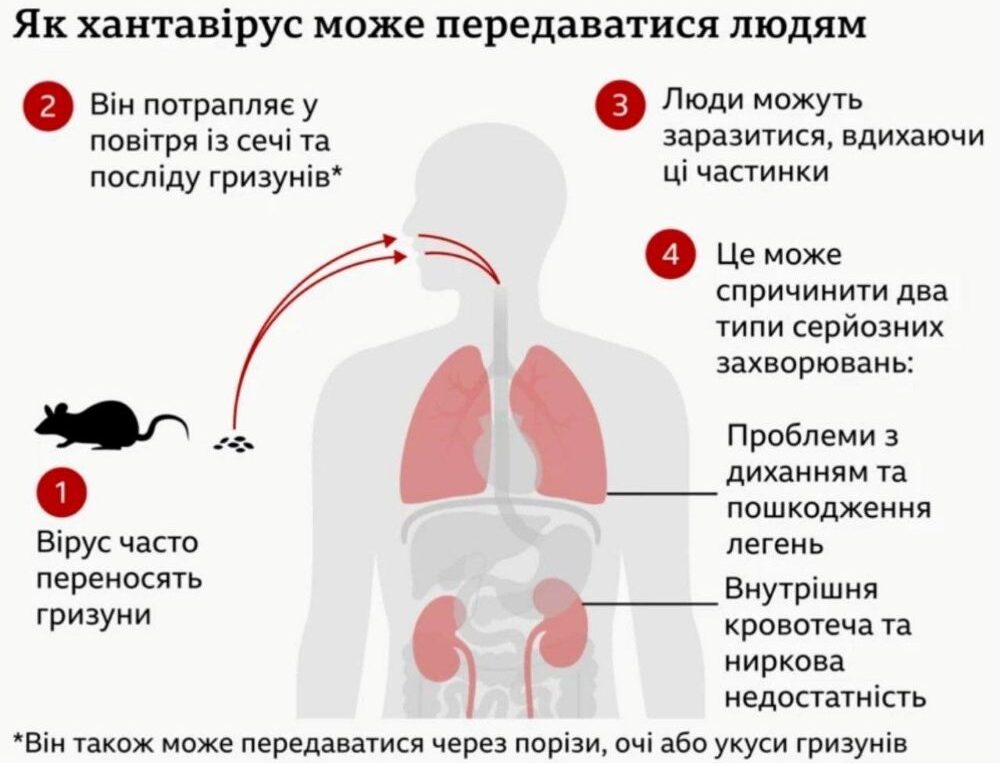 Hantavirus 