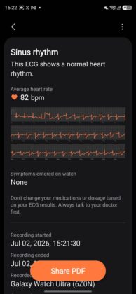 Samsug Galaxy Watch Ultra2 — Health Monitor