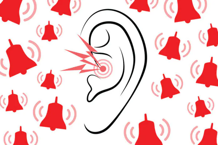 Quali sono le migliori soluzioni per i bambini: lavoro da parte degli audiologi